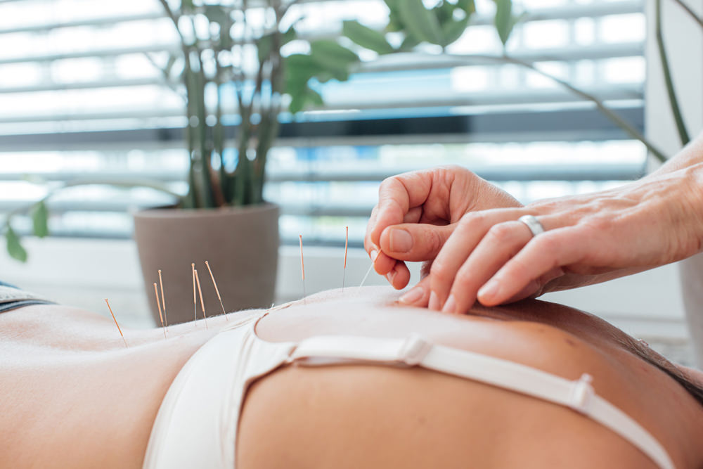 Internisten Frankfurt Sachsenhausen - Stöppel, Klimitz, Zücker - Leistungen - Schmerztherapie und Akupunktur